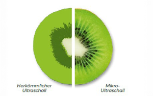 Grafik: ExactVu