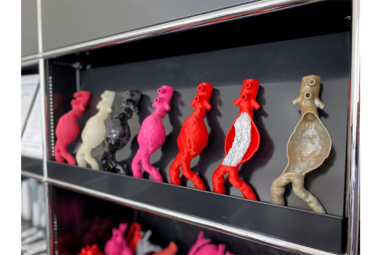 3D-gedruckte patientenspezifische Modelle der Aorta - Variante 2
