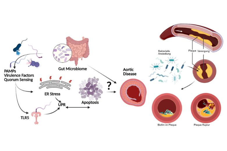Übersicht des Einflusses des eigenen Darm Mikrobioms und bakterieller Biofilme auf den Verlauf verschiedener Gefäßerkrankungen