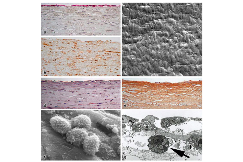 In-vitro-Modell der humanen Gefäßwand