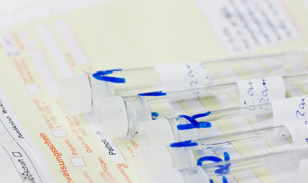 pathologie_teaser_XL_780x464_04_einsender_info_01