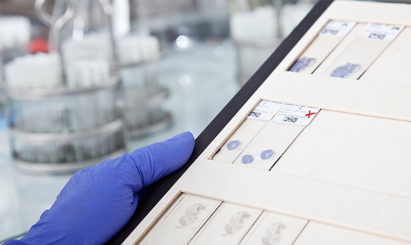 pathologie_teaser_XL_780x464_05_befundauskunft