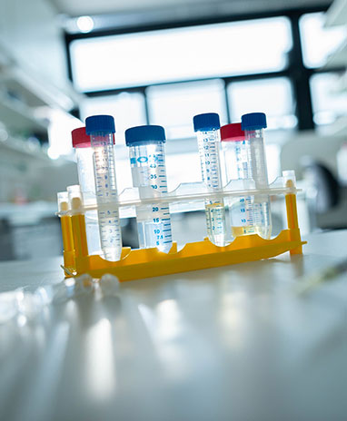 teaser-l-roehrchen-chw-3663-humangenetik-ukk.jpg
