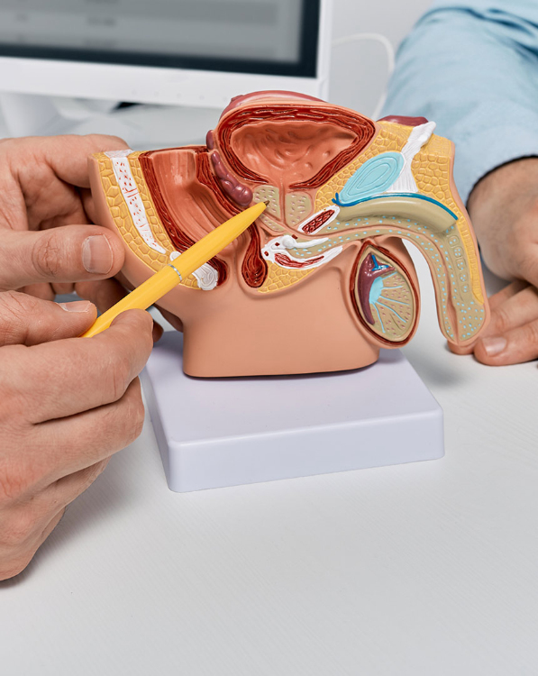 teaser-xl-prostatakarzinom-modell-adobestock-591088878.jpg