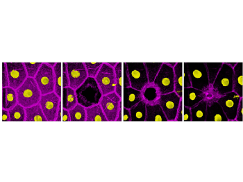 Wundheilungsverlauf in Drosophila (v. l.): Nach Entfernung des Zellkerns (gelb) schließt sich die Zellmembran (pink) um die Wundstelle. © MPI für Biologie des Alterns