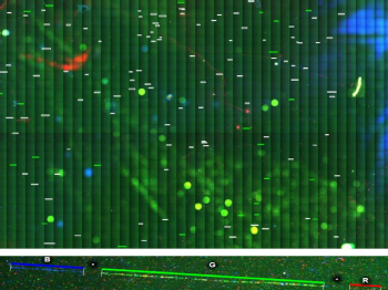 Langezogene DNA-Stränge eines Patienten wurden auf eine sehr dünne Glasscheibe aufgebracht (molecular combing) und mit fluoreszierenden Sonden angefärbt. Die grünen Banden geben die Kopienzahl des Makrosatelliten DXZ4 an, Bild: Eike Strathmann