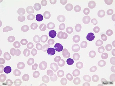 Zytopathologie & Knochenmarkpathologie - Pathologie