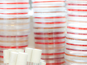 Antibiotika-Therapie-Optimierungs-Studie
