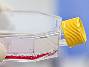 Foto: Uniklinik Köln