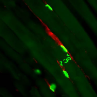 Neuromuskuläre Endplatte mit innervierendem Axon (rot), Quelle: Uniklinik Köln