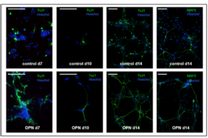 Generation of TuJ1-positive neurons (green) from neural stem cells during differentiation was increased by OPN treatment (lower row) as compared to control (upper row) at days 7, 10, and 14 after mitogen withdrawal. During that period, the axon length grew notably and neurons began to form networks; both observations were more pronounced in OPN-treated neural stem cells. By day 14, mature MAP2+-positive neurons had formed (right column; scale bars represent 100 μm). From: Rabenstein et al., Stem Cell Research & Therapy 2015.