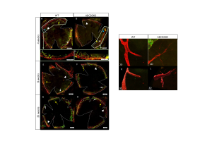 Figure 2  Immunolocalization of CD31 (red, blood vessels) and LYVE-1 (green, lymphatic vessels) on corneal whole-mounts of WT and ABCB5KO mice aged 4 (A,B), 8 (E,F), and 26 weeks (G,H). (I–L) 400× magnification for blood vessels sprouting in WT and ABCB5 KO 4-week-old mice with thin extensions grow out in the ABCB5 KO, 2D (I,J) 3D (K,L). Sprouts, blood sprouts, branching points, and endpoints are highlighted with white arrows, blue arrows, yellow arrows, and white arrowheads, respectively. Representative image showing a closer look at blood vessel morphology (C,D).