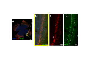 Figure 3. Images illustrating CPD recovery in CPDPL mutant mice following UVB exposure and 30 min photorecovery. CPDs stained with Alexa555 ((A–C) shown here in red) and stem cell marker p63a stained with Alexa488 ((A,B,D) shown here in green). Cells positive for CPDs inside the limbus are indicated by arrows in (C). Images were taken after 1 J/cm2 UVB 30 min photorecovery. CPD immunofluorescence was particularly concentrated in limbal region and generally absent in central cornea.