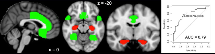 The cortex-to-hippocampus ratio discriminates non-AD co-pathologies.