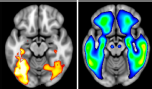 Neuronal activation in brain areas 